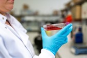 SERNAC denuncia a banco de células madre por publicitar tratamiento para curar el Coronavirus
